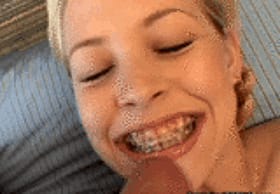 Get Your Braces On: A Cumshot-Filled Experience'