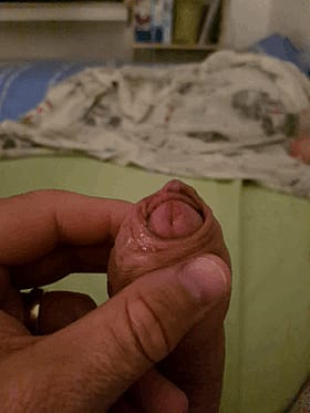 Uncut Amateur Foreskin Penis: A Close-Up Look'